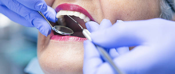 Best Urgent Tooth Repair  in Creve Coeur, IL